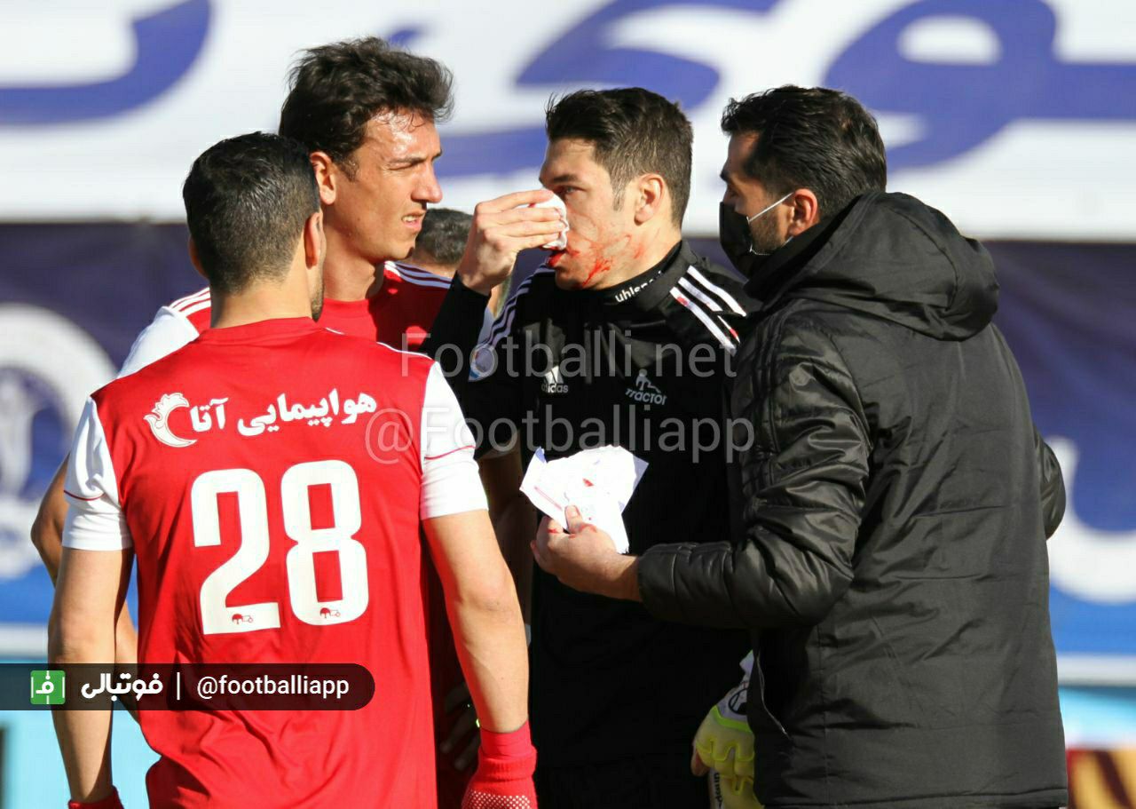 حادثه در سیرجان؛ شکستگی خونین بینی اخباری (عکس)