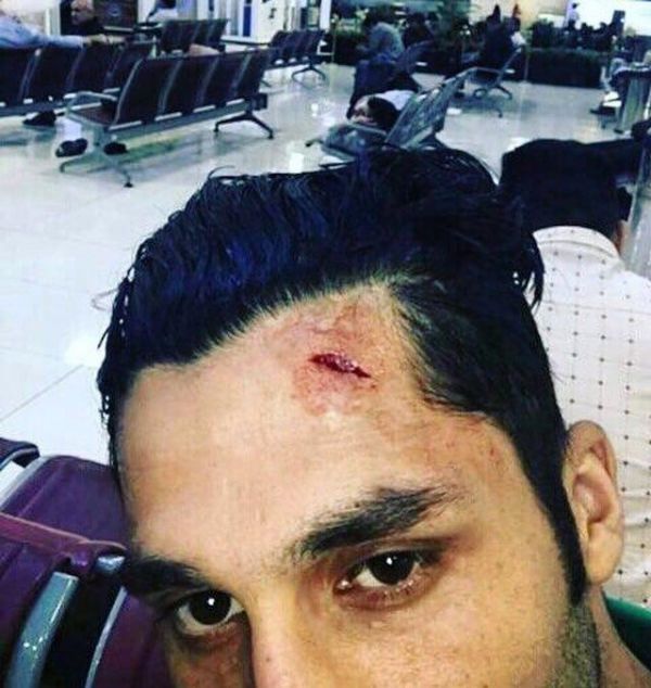 جای استوک سزار روی پیشانی مظاهری عکس