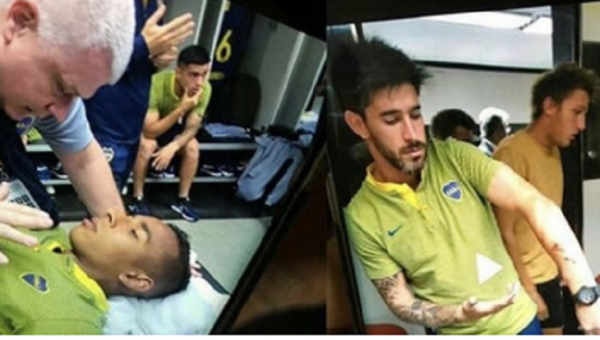  انتقال دوبازیکن بوکاجونیورز به بیمارستان