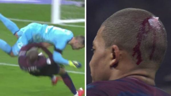  اولین واکنش امباپه پس از مصدومیت ترسناک  عکس