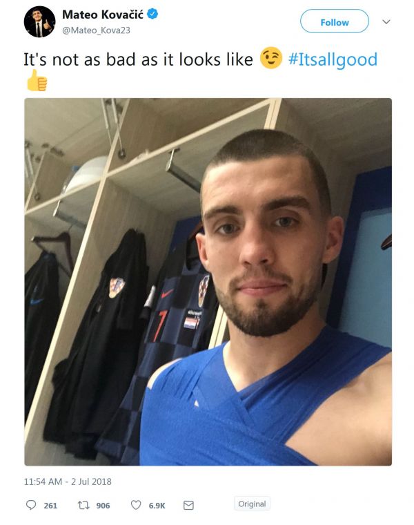  مصدومیت ستاره کرواسی جدی نیست  عکس