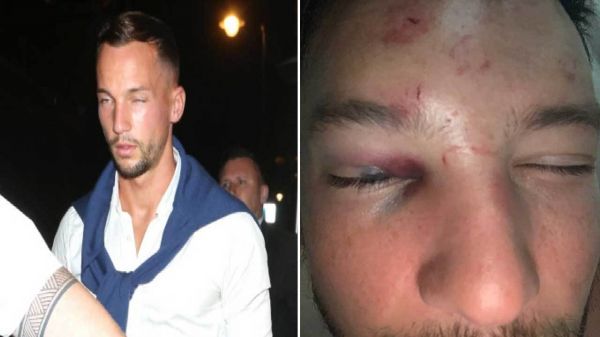 حمله خونین به بازیکن قرضی چلسی در خیابان