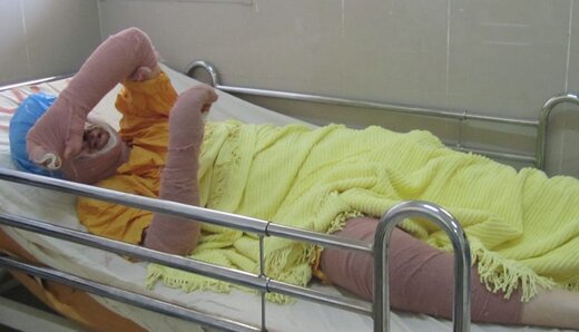  «دختر آبی» درگذشت