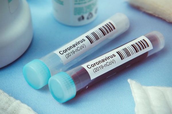 آخرین آمار کرونا در کشور فوت ۵۵ نفر در ۲۴ ساعت گذشته