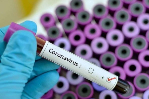  مدعیان قهرمانی لیگ برتر دوباره تست کرونا می دهند