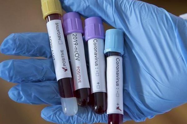  ستاد مبارزه با کرونا در فدراسیون تشکیل شد  معرفی آزمایشگاه مورد تایید برای تست‌ کرونا