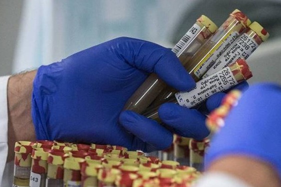  اخذ 22 نمونه تست دوپینگ از مسابقات فوتبال و فوتسال