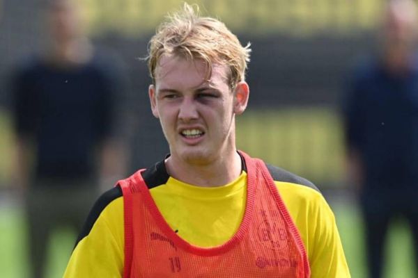 حضور ستاره دورتموند در تمرین با چشم کبود