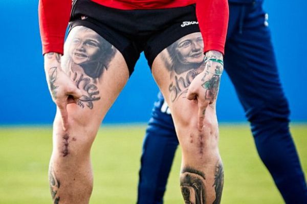  عکس؛ پز دادن مهاجم محبوب اوساسونا با بخیه‌های روی زانوهایش