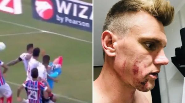  عذرخواهی مدافع برزیلی پس از ضربه وحشیانه در لیگ برزیل