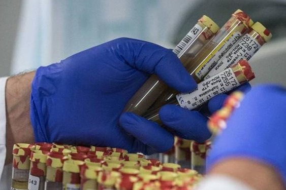 تنها بانوی المپیکی وزنهبرداری تست دوپینگ داد