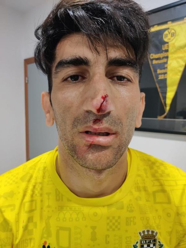  تصویری از علیرضا بیرانوند که در فضای مجازی منتشر شده و گویا علی بیرو در تمرینات بواویشتا چنین وضعیتی پیدا کرده است