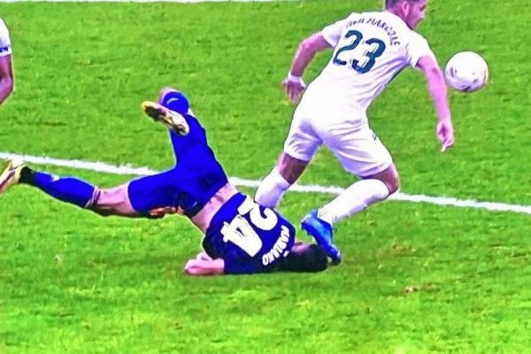 عکس؛ فرود خطرناک مهاجم رئال مادرید که باعث بخیه خوردن ابروی او شد