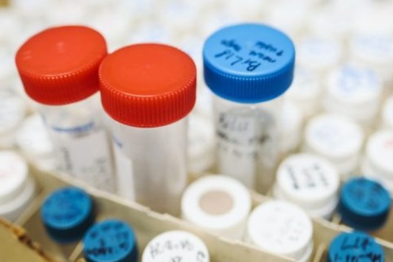 نمونهگیری تست دوپینگ در انتخابی کشتی فرنگی حضور ماموران نادو در جام تختی