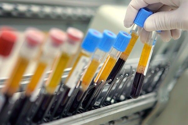 آغاز تست دوپینگ خارج از مسابقات فوتبال در ایران