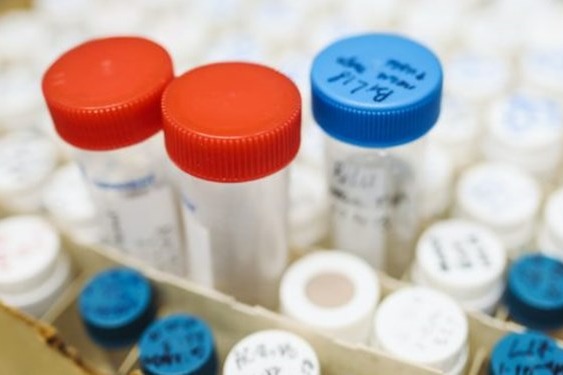  بررسی پرونده ۶ دوپینگی در ایران نادو