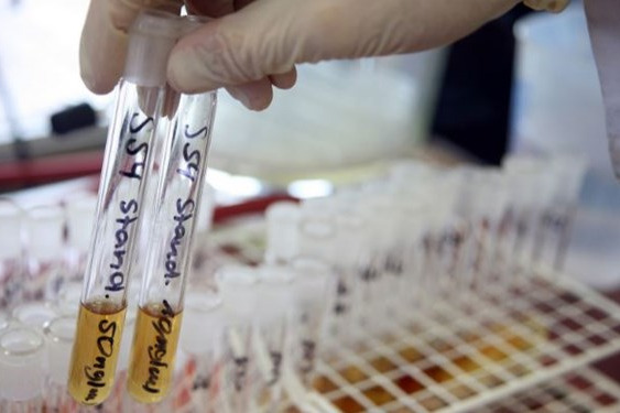  بررسی پرونده ۵ ورزشکار دوپینگی و صدور رای