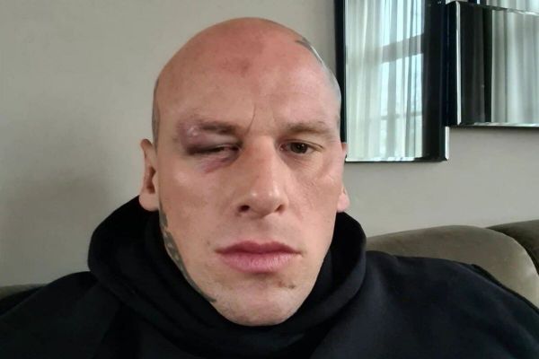 واکنش مارتین فورد به تحقیر هالک ایرانی؛ انسانی که دچار توهم شده را اذیت کردند