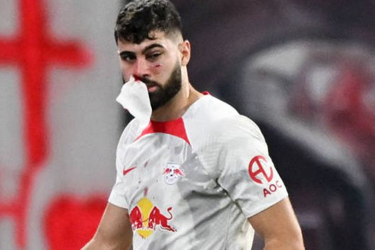 بازیکن کروات روانه بیمارستان شد؛ شبیه بوکسورها پس از 12 راند مبارزه