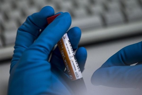 روایت تازه از داستان نمونههای دوپینگ کشتیگیران؛ پست و گمرک آلمان مقصر شدند