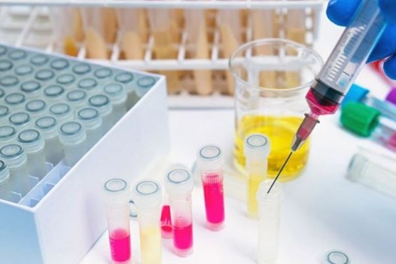 توضیحات مدیرکل دفتر ارتباطات پست درباره برگشت مرسوله تست دوپینگ کشتیگیران