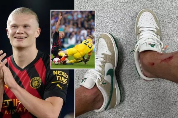 تصویر هالند از زخمهای پایش بعد از بازی مقابل برایتون