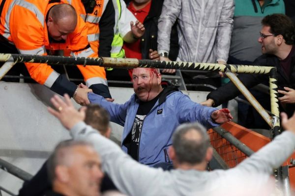  عکس؛ سقوط هوادار لیدز از روی سکوهای ورزشگاه