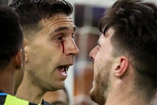  عکس؛ درگیری دروازه‌بان پرحاشیه آرژانتینی با هم‌تیمی‌های سابقش