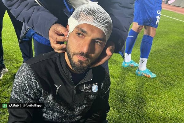 هواداران پرسپولیس سر بازیکن استقلال را شکستند + تصاویر