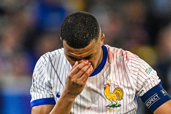  کیلیان امباپه نمی‌خواهد بینی خود را عمل کند