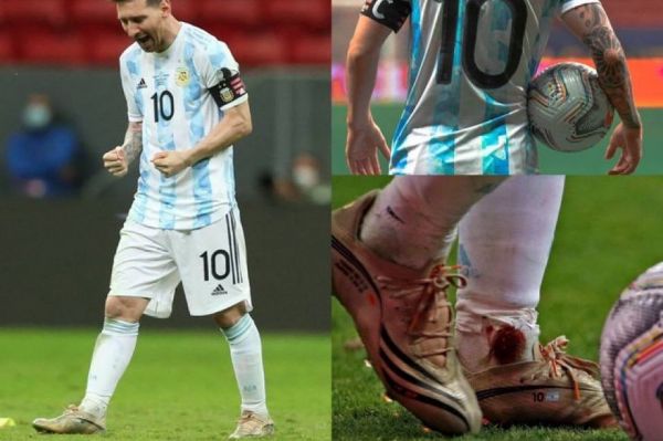  عکس؛ وقتی پای مسی مقابل کلمبیایی‌ها خونی شد