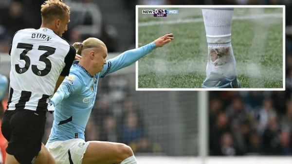  عکس؛ لحظه‌ای که مچ پای هالند خونی شد