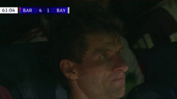 سوژه شدن چهره توماس مولر قبل و بعد از بازی مقابل بارسلونا عکس