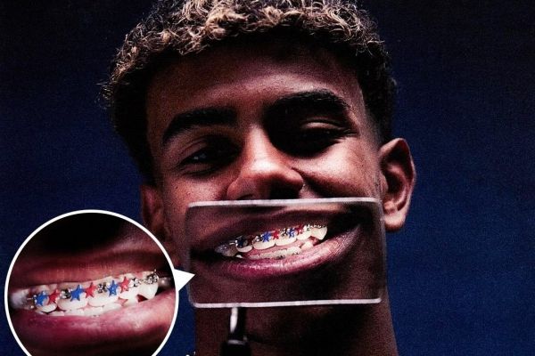  عکس؛ ارتودنسی ویژه لامین یامال برای ال کلاسیکو