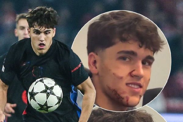 عکس؛ وضعیت صورت بازیکن بارسلونا پس از خطای خشن؛ نیاز به 10 عدد بخیه