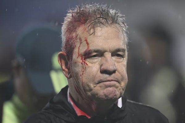  عکس؛ خونریزی از ناحیه سر برای مربی سرشناس مکزیکی