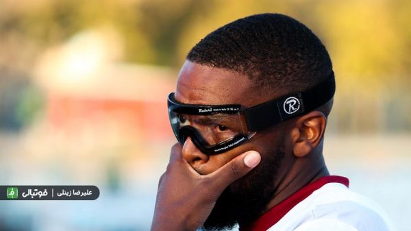  گزارش ویژه  بالاخره به صورت رسمی تایید شد؛ چشم چپ یامگا کاملا نابینا شده است