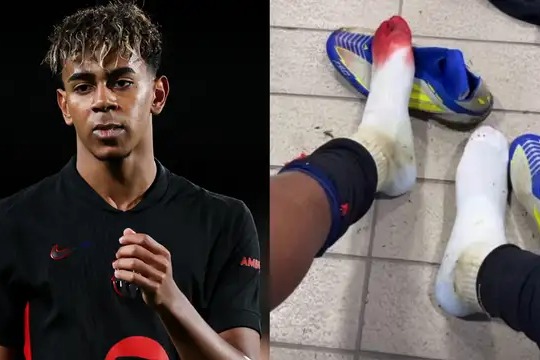  عکس؛ اعتراض ستاره بارسلونا با جوراب خونین