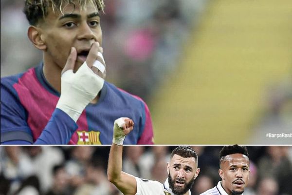  عکس؛ بانداژ دست لامین یامال شبیه به کریم بنزما