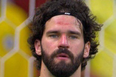  رسمی؛ دروازه‌بان لیورپول اردوی برزیل را ترک کرد