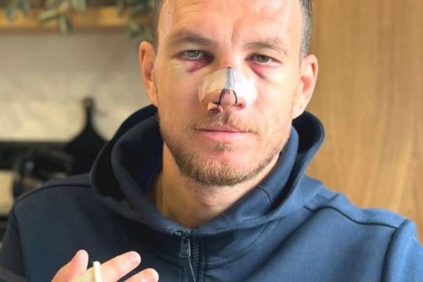  شوخی بالوتلی با دماغ ژکو پس از مصدومیت وحشتناک