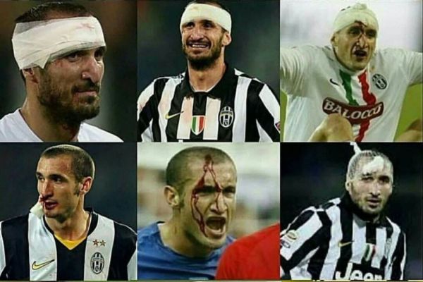 جورجیو کیهلینی؛ گلادیاتوری که بخیههای عمیق هم او را متوقف نمیکرد