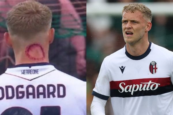  عکس؛ اثر دندان‌های یک زامبی بر روی گردن اودگارد