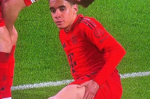  مصدومیت بدموقع ستاره بایرن‌مونیخ در آستانه بازی با اینتر