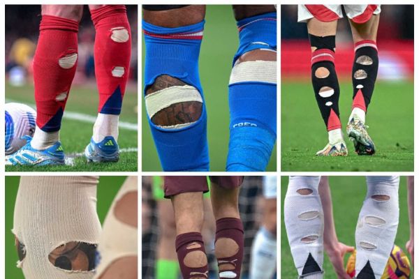  راز جوراب‌های پاره بازیکنان فوتبال جهان