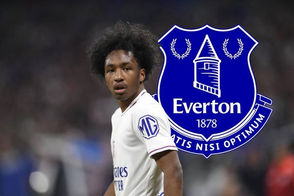  استعداد ناب لیون نزدیک به امضای قرارداد با اورتون