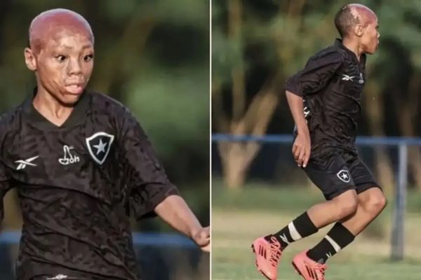  از معجزه بقا پس از سوختگی تا ورود به بوتافوگو