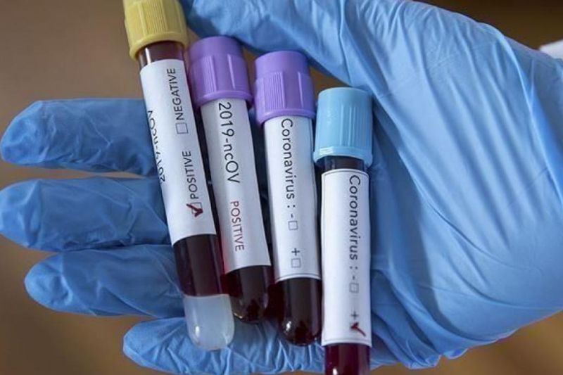 ستاد مبارزه با کرونا در فدراسیون تشکیل شد/ معرفی آزمایشگاه مورد تایید برای تست کرونا