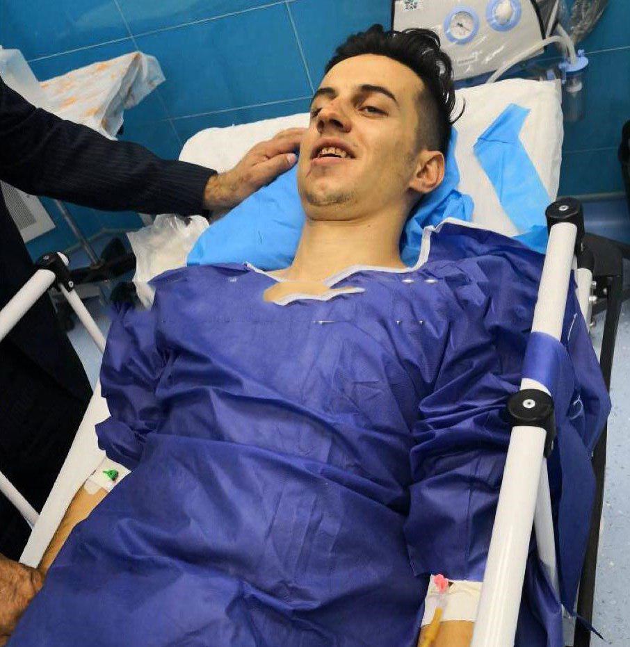 گلزن مصدوم ذوب آهن از بیمارستان مرخص شد