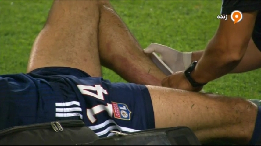 اخراج فابرگاس در بازی افتتاحیه لیگ فرانسه مقابل لیون